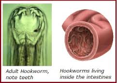 Hookworms - Inside the intestine and showing teeth